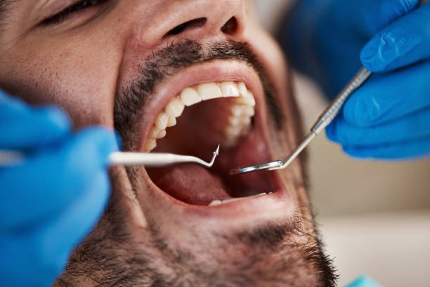 Best Emergency Dental Care for Broken or Chipped Teeth in Andale, KS